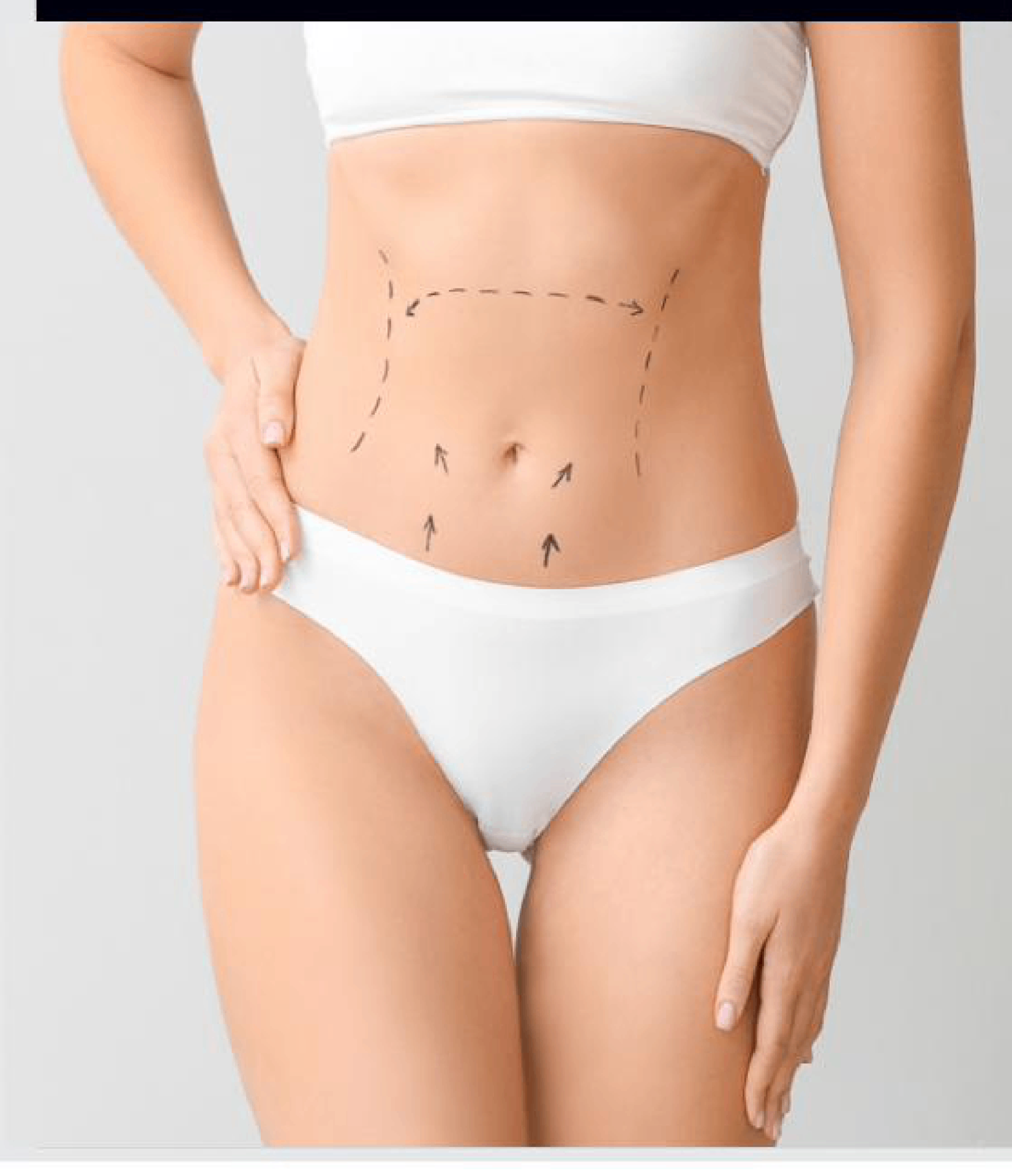 Lipoaspiração / Lipo HD